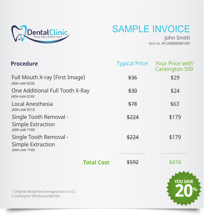 Simple Tooth Extraction 1Dental